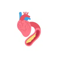 Coronary arteries in English