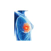 Disease Names | Breast Cancer in English