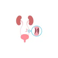 Internal Body Parts Names |Ureteric orifices in English