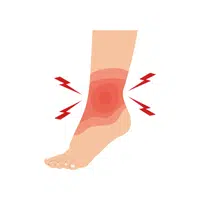 Ankle Thing that Start with A 