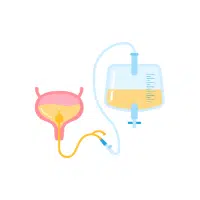Catheter | Surgical Instruments Names in English