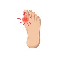 Big toe