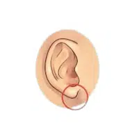 Earlobe