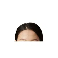 Forehead