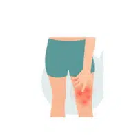 Hamstring
